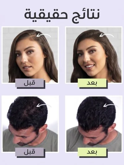 الياف لملء فراغات الشعر من Toppik